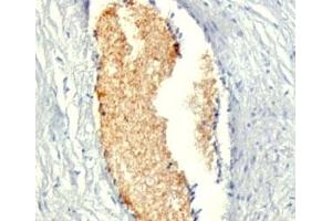 Formalin-fixed, paraffin-embedded human placenta stained with AMPD3 antibody (AMPD3/901) (AMPD3 抗体)