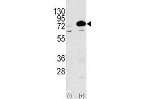 Western Blotting (WB) image for anti-ATG7 Autophagy Related 7 (ATG7) (AA 22-51) antibody (ABIN3030039)