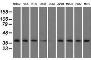 Western blot analysis of extracts (35 µg) from 9 different cell lines by using anti-HIBCH monoclonal antibody. (HIBCH 抗体)
