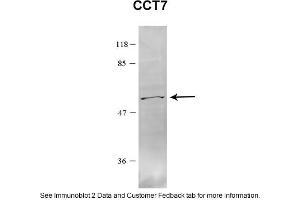 Sample Type: HEK 293 (10ug)Primary Dilution: 1:1000Secondary Antibody: conjugated goat anti-rabbitSecondary Dilution: 1:10,000Image Submitted By: Amy GrayBrigham Young University (CCT7 抗体  (C-Term))