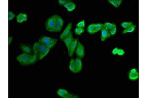 Immunofluorescence staining of HepG2 cells with ABIN7149534 at 1:400, counter-stained with DAPI. (Nitrilase 1 抗体  (AA 1-243))