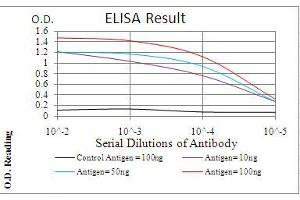 Black line: Control Antigen (100 ng), Purple line: Antigen(10 ng), Blue line: Antigen (50 ng), Red line: Antigen (100 ng), (PDPK1 抗体  (AA 457-556))