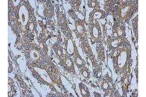 Image no. 1 for anti-Fermitin Family Member 3 (FERMT3) (AA 106-371) antibody (ABIN1501989) (FERMT3 抗体  (AA 106-371))
