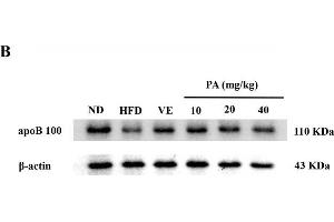 PA treatment attenuated HFD-induced apoB 100 reduction in rats. (APOB 抗体  (AA 28-330))