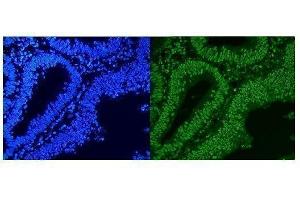IF analysis of HnRNP A1 using anti-HnRNP A1 antibody (ABIN4886621). (HNRNPA1 抗体  (N-Term))