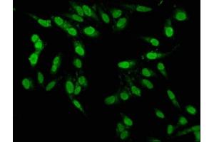 Immunofluorescence staining of Hela cells with ABIN7164137 at 1:100, counter-stained with DAPI. (PBX1 抗体  (AA 315-430))