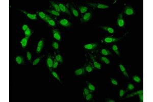 Immunofluorescence staining of Hela cells with ABIN7164137 at 1:100, counter-stained with DAPI. (PBX1 抗体  (AA 315-430))
