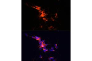 Immunofluorescence analysis of SH-SY5Y cells using βIII-Tubulin/β3-Tubulin Rabbit mAb (ABIN7271049) at dilution of 1:100 (40x lens). (TUBB3 抗体)