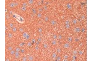 Detection of SPTAN1 in Rat Cerebrum Tissue using Polyclonal Antibody to Alpha-Fodrin (SPTAN1) (SPTAN1 抗体  (AA 2071-2269))