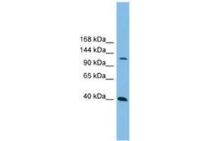 Image no. 1 for anti-Mitogen-Activated Protein Kinase Kinase Kinase 14 (MAP3K14) (AA 71-120) antibody (ABIN6744716)