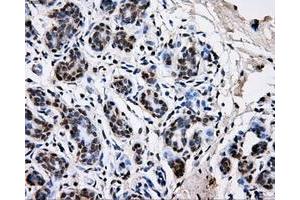 Immunohistochemical staining of paraffin-embedded breast tissue using anti-PKMYT1 mouse monoclonal antibody. (PKMYT1 抗体)