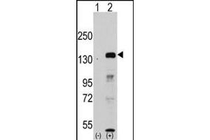 Western blot analysis of JHDM1a/FBXL11 (arrow) using rabbit polyclonal JHDM1a/FBXL11 Antibody (Center) (ABIN387896 and ABIN2844142). (KDM2A 抗体  (AA 500-527))