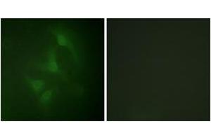 Immunofluorescence analysis of HeLa cells, using JNK1/2/3 (Ab-183/185) Antibody. (JNK 抗体  (AA 151-200))