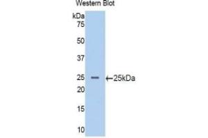 WB of Protein Standard: different control antibodies against Highly purified E.