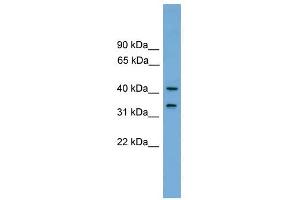 FAM118A antibody used at 1 ug/ml to detect target protein. (FAM118A 抗体  (Middle Region))