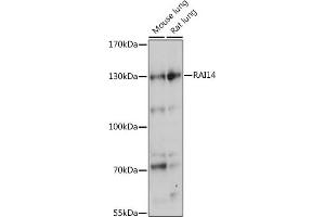 Western blot analysis of extracts of various cell lines, using R antibody (ABIN7269945) at 1:1000 dilution. (RAI14 抗体  (AA 300-600))