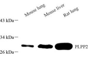 Western blot analysis of PLPP2 (ABIN7075037),at dilution of 1: 1500 (PPAP2C 抗体)