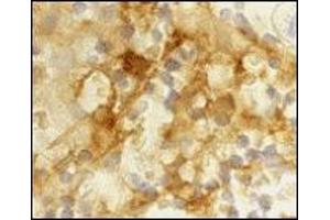 Immunohistochemistry (IHC) image for anti-CD209 (CD209) (Extracellular Domain) antibody (ABIN492510) (DC-SIGN/CD209 抗体  (Extracellular Domain))