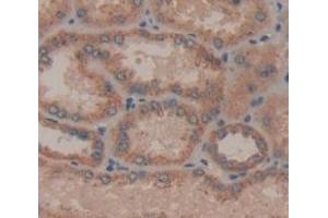Immunohistochemistry (IHC) image for anti-C1q and Tumor Necrosis Factor Related Protein 1 (C1QTNF1) (AA 26-281) antibody (ABIN1866962)