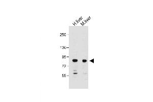 All lanes : Anti-MUT Antibody (N-Term) at 1:2000 dilution Lane 1: Human liver lysate Lane 2: Mouse liver lysate Lysates/proteins at 20 μg per lane. (MUT 抗体  (AA 32-66))