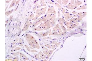 Formalin-fixed and paraffin embedded rat tongue tissue labeled with Anti-IL-17/IL-17A Polyclonal Antibody, Unconjugated (ABIN738891) at 1:600 followed by conjugation to the secondary antibody and DAB staining (IL-17 抗体  (AA 85-150))