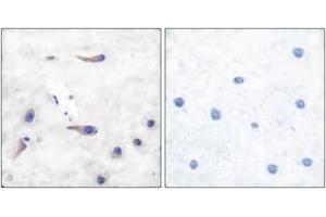 Immunohistochemistry analysis of paraffin-embedded human brain tissue, using MARCKS (Ab-163) Antibody.