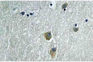 Immunohistochemistry (IHC) analyzes of PAKalpha antibody in paraffin-embedded human brain tissue. (PAK1 抗体)