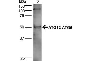 Western blot analysis of Human Cervical cancer cell line (HeLa) lysate showing detection of ~32. (ATG5 抗体  (N-Term) (APC))