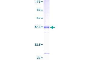 MLF1IP Protein (AA 1-176) (GST tag)