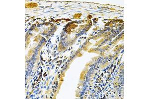 Immunohistochemistry of paraffin-embedded mouse intestine using RRAGC Antibody (ABIN5975563) at dilution of 1/100 (40x lens). (GTR2 抗体)