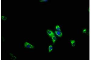 Immunofluorescence staining of HepG2 cells with ABIN7163295 at 1:200, counter-stained with DAPI. (PIK3R5 抗体  (Regulatory Subunit 5))