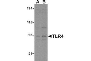 Image no. 1 for anti-Toll-Like Receptor 4 (TLR4) (N-Term) antibody (ABIN951277) (TLR4 抗体  (N-Term))