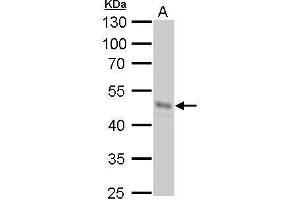 WB Image GNAS antibody [C2C3-2], C-term detects GNAS protein by Western blot analysis. (GNAS 抗体)