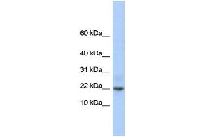WB Suggested Anti-C9orf25 Antibody Titration: 0. (C9orf25 抗体  (Middle Region))