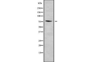 Western blot analysis of ZNF7 using COLO205 whole cell lysates (ZNF7 抗体  (Internal Region))