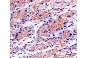 Immunohistochemistry (IHC) image for anti-Prohibitin (PHB) antibody (ABIN3028947)