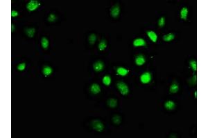 Immunofluorescence staining of A549 cells with ABIN7152557 at 1:66, counter-stained with DAPI. (FANCI 抗体  (AA 180-252))