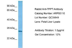 Western Blotting (WB) image for anti-TCF3 (E2A) Fusion Partner (In Childhood Leukemia) (TFPT) (C-Term) antibody (ABIN2790046) (TFPT 抗体  (C-Term))