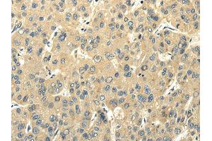 Immunohistochemistry (IHC) image for anti-Peripheral Myelin Protein 2 (PMP2) antibody (ABIN5961300) (PMP2 抗体)