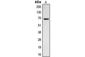 Western blot analysis of CDC23 expression in Jurkat (A) whole cell lysates. (CDC23 抗体  (Center))