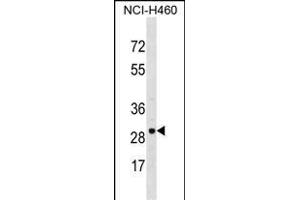 VDAC3 Antibody (Center) (ABIN1537893 and ABIN2848739) western blot analysis in NCI- cell line lysates (35 μg/lane). (VDAC3 抗体  (AA 156-183))