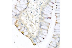 Immunohistochemistry of paraffin-embedded human colon using CPA1 antibody at dilution of 1:100 (40x lens). (CPA1 抗体)