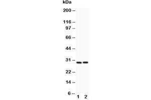 Western blot testing of Bcl2A1 antibody and (1) HeLa, (2) Jurkat lysate (BCL2A1 抗体  (N-Term))