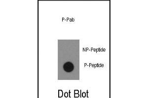 Dot blot analysis of anti-Phospho-ABL1- Antibody (ABIN389501 and ABIN2839559) on nitrocellulose membrane.