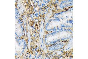 Immunohistochemistry of paraffin-embedded rat lung using Collagen VI/COL6 Rabbit mAb (ABIN7266462) at dilution of 1:100 (40x lens). (COL6A1 抗体)