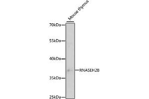 Western blot analysis of extracts of mouse thymus, using RNB antibody (ABIN6133304, ABIN6146990, ABIN6146991 and ABIN6220814) at 1:3000 dilution. (RNASEH2B 抗体  (AA 1-290))