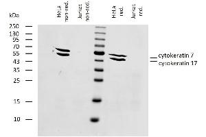 Western Blotting (WB) image for anti-Keratin 7/17 (KRT7/17) antibody (ABIN94296)