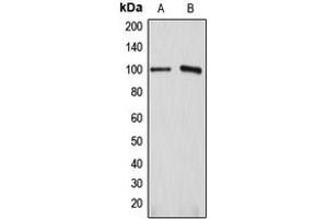 Western blot analysis of ATP1A1 expression in HEK293T (A), HeLa (B) whole cell lysates. (ATP1A1 抗体  (Center))