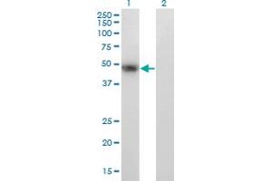 Western Blot analysis of PAX8 expression in transfected 293T cell line by PAX8 monoclonal antibody (M23), clone 2F1. (PAX8 抗体  (AA 141-250))