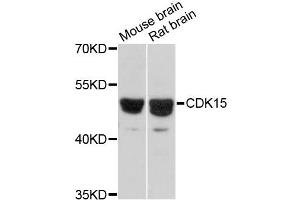 Western blot analysis of extracts of various cell lines, using CDK15 antibody (ABIN6292714) at 1:3000 dilution. (Cyclin-Dependent Kinase 15 (ALS2CR7) 抗体)